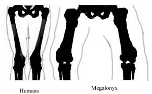 bicondylar angle